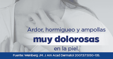 Imagen de sintomatolog&iacute;a del herpes z&oacute;ster 2